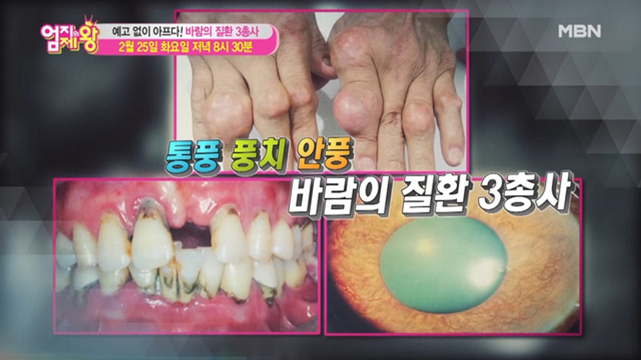 엄지의 제왕 371회 [예고 없이 아프다! 바람의 질환 3총사]