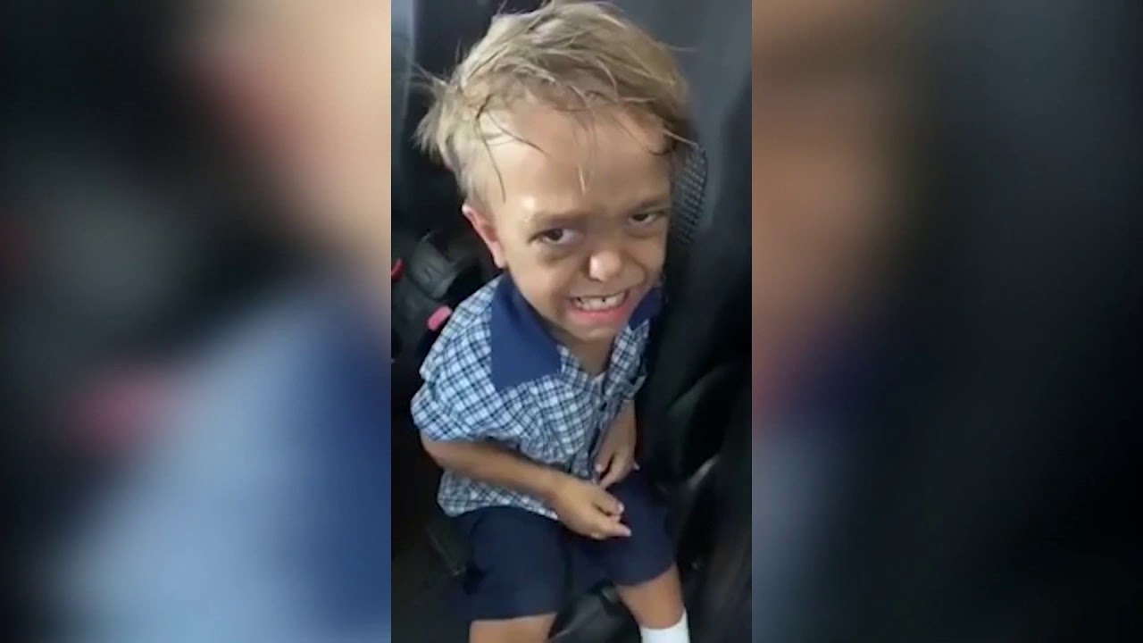 9-vjecari me nanizem prek opinionin boteror