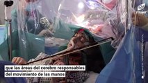 Mujer se sometió a cirugía de cerebro para salvar sus manos mientras tocaba el violín