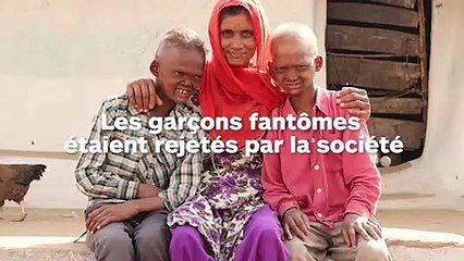 Dents pointues, cheveux rares, voix grinçantes  ces deux frères malades étaient considérés comme des fantômes