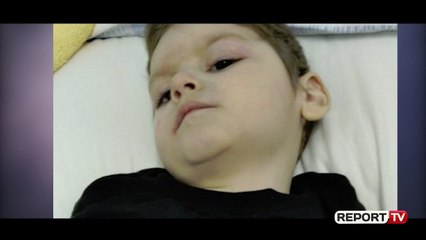 Report TV -2-vjeçari diagnostikohet me sëmundjen e rrallë pasi u dëmtua gjatë lindjes