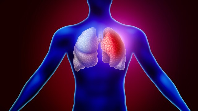 Fourth Person In Italy Dies From Coronavirus