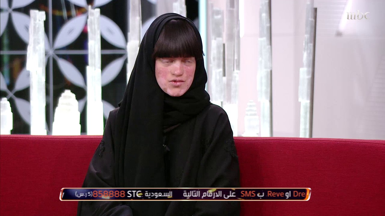 أبرار آل عثمان تكشف عن أسباب مرض انحلال الجلد الفقاعي وكيفية العلاج يوميا