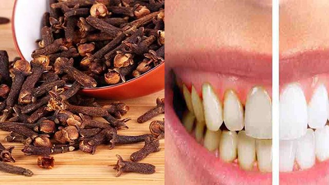 लौंग के हैरान कर देने वाले फायदे । Health Benefits of Cloves । Boldsky