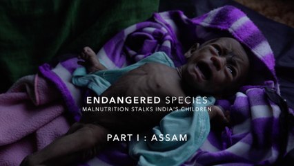Why Are Most of India's Malnourished Children in Assam?