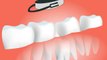 Dental surgery' Tooth-teeth-dentist_-_dental surgery in Hindi Urdu, dental surgery meaning,