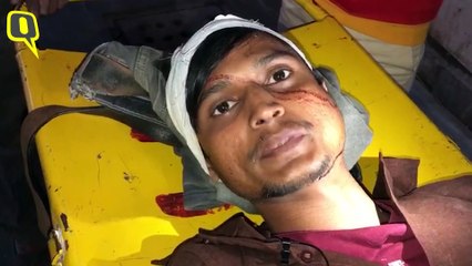 Delhi Violence: Here's What the Injured & Hospital Officials Have to Say