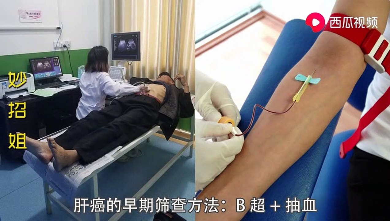 【Prevent cancer】一查就是癌症晚期？6大高发癌的预警信号和筛查方法，赶紧收藏