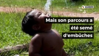 Le garçon de 2 ans qui fumait 40 cigarettes par jour a bien changé