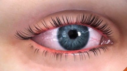 bd-ojo-seco-causas-y-tratamientos-250220