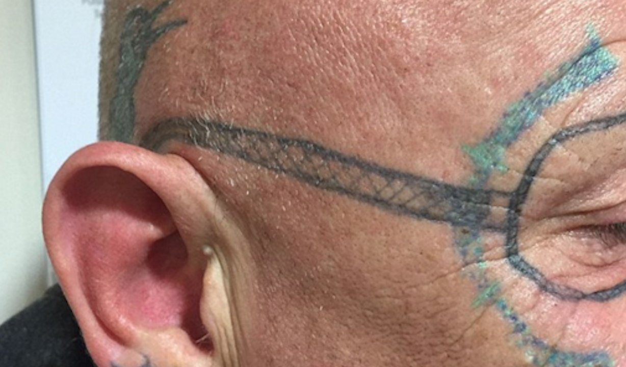 Il se retrouve avec des lunettes tatouées sur le visage après une soirée trop arrosée