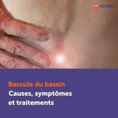 Bascule du bassin : causes & traitements