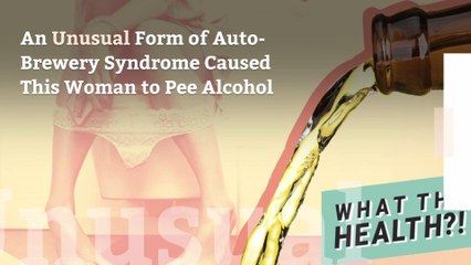 An Unusual Form of Auto-Brewery Syndrome Caused This Woman to Pee Alcohol
