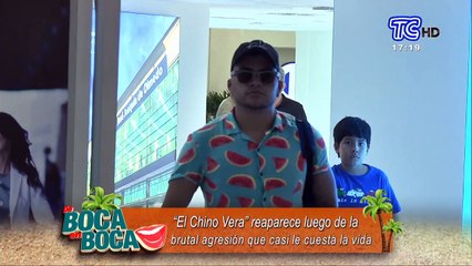 "El Chino Vera" reaparece tras brutal agresión que casi le cuesta la vida