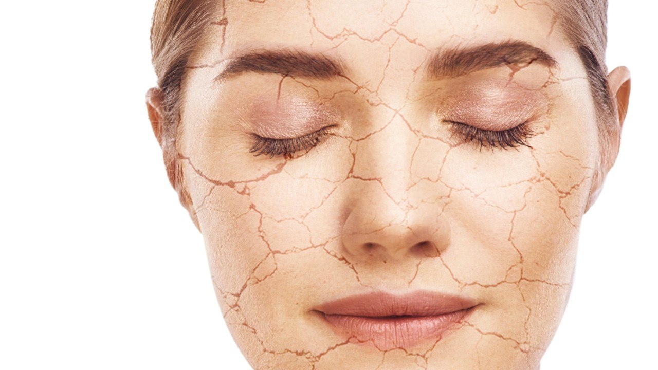 How Your Allergy Medicine Can Mess With Your Skin