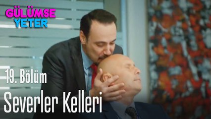 Severler kelleri - Gülümse Yeter 19. Bölüm