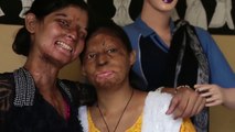 Mujeres indias víctimas de ataques con ácido