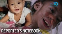 Reporter's Notebook: Lola, humihingi ng tulong para maipagamot ang apo!