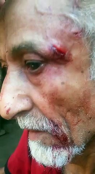 الحوثيون يعتدون بالضرب على مسن