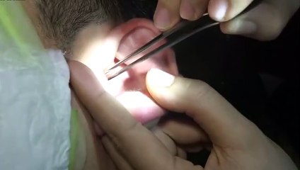 종로출장서비스 종로출장서비스O7Ox7620x1146 {카톡BO57} 종로출장마사지샵 종로출장안마on종로출장안마cos여3♪⇔∃마사지황형♥◥≪