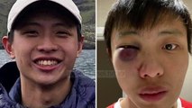 “Nuk e dua koronavirusin tuaj në vendin tim”/ Dhunohet 23-vjeçari nga Singapori