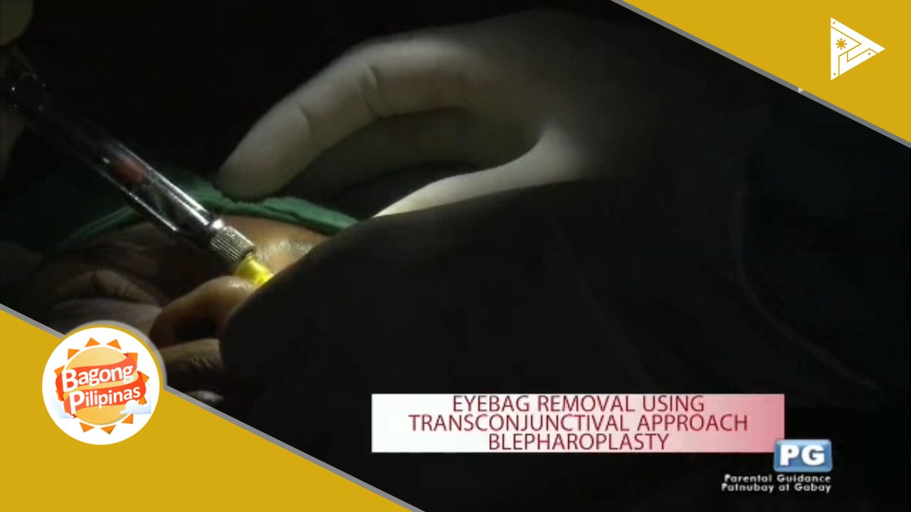 DERMAESTHETIQUE: Blepharoplasty