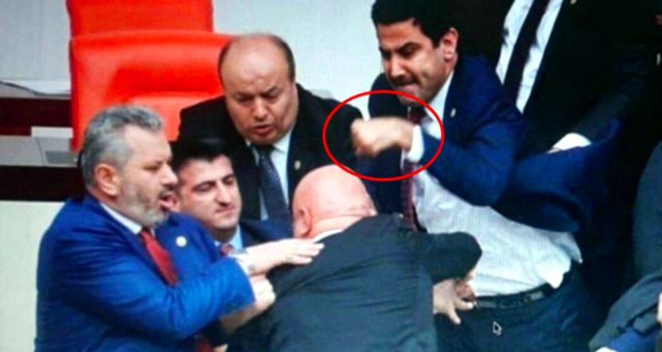 AK Partili vekilin eli, CHP'li Engin Özkoç'a attığı yumruk nedeniyle üç yerden kırıldı