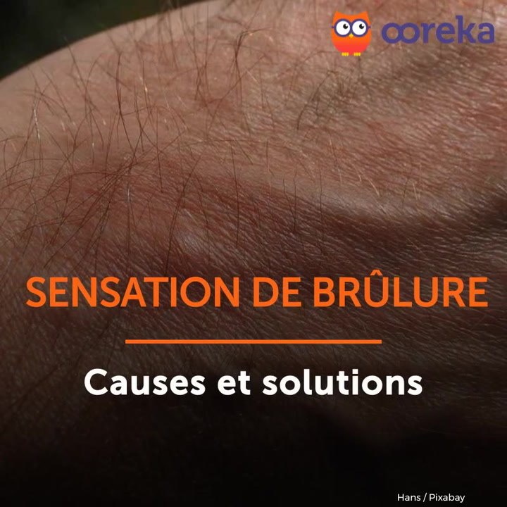Sensation de brûlure