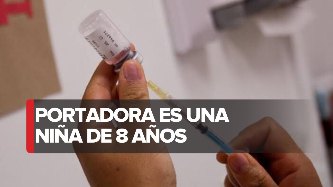Reportan caso de sarampión en niña de CdMx; hay 3 casos sospechosos