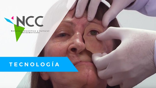 Investigadores crean prótesis faciales más económicas y en menos tiempo gracias a la impresión 3D