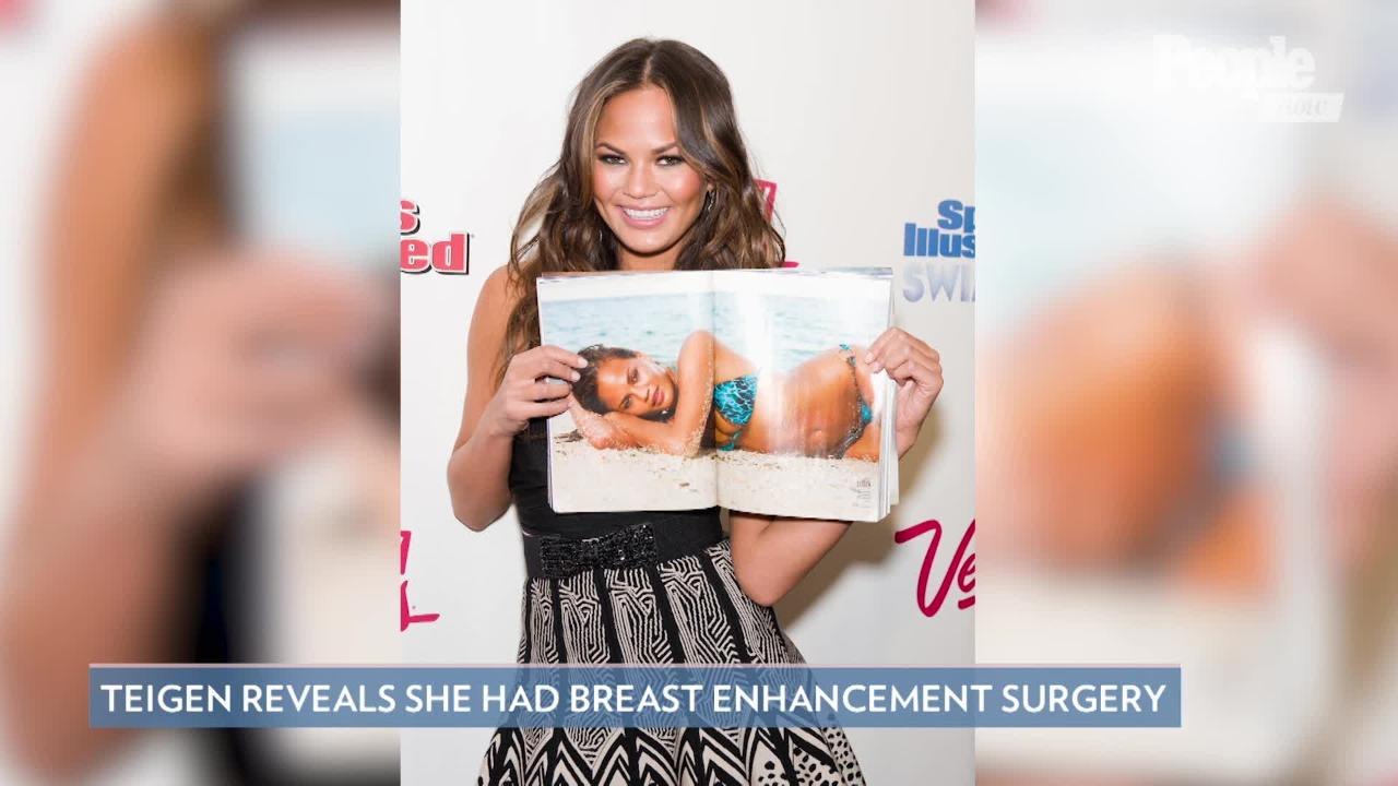 Chrissy Teigen Candidly Reveals She Has Breast Implants — But Says She Wants 'Them Out Now'