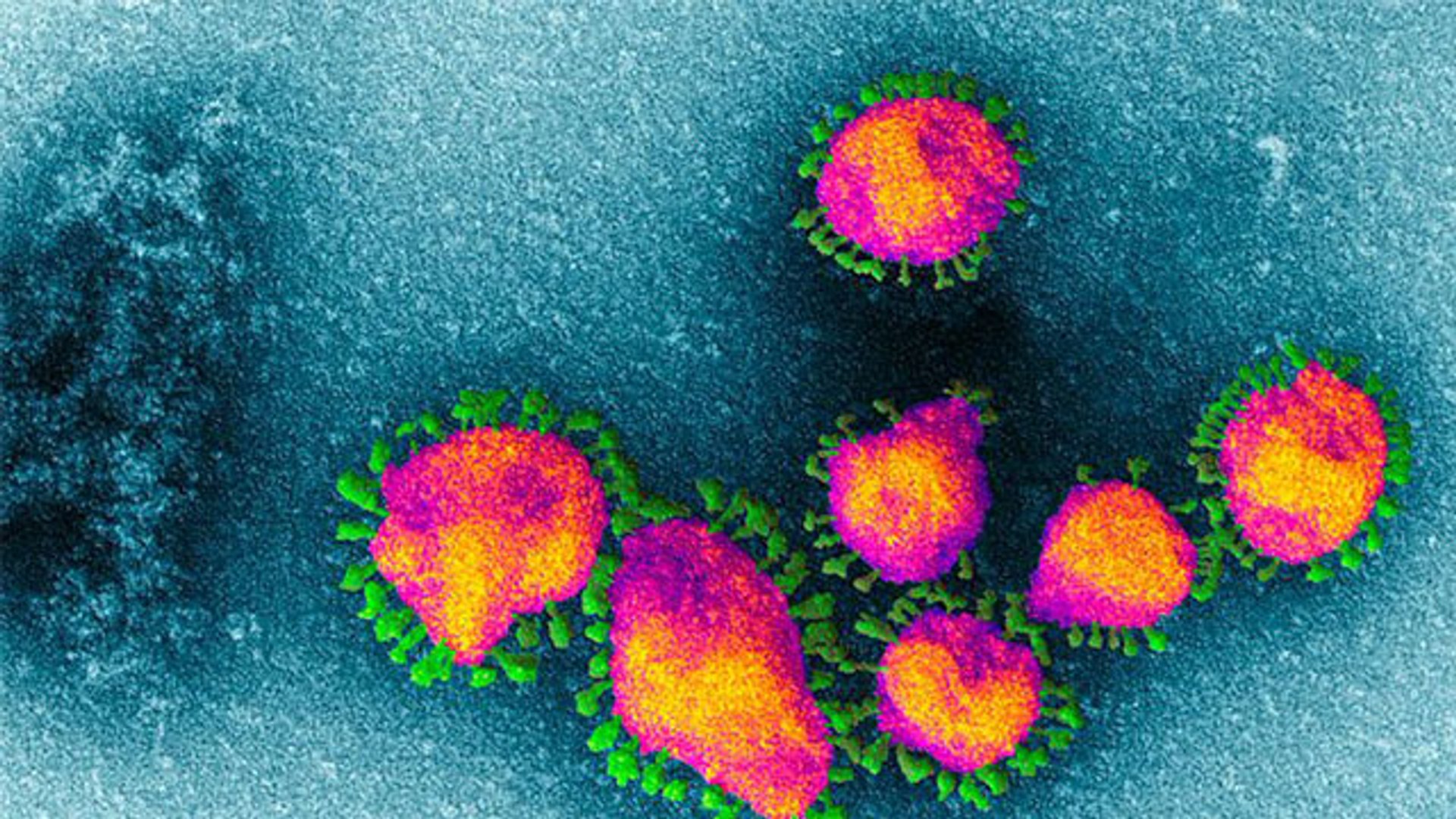 ⁣Coronavirus : कोरोना वायरस रूप बदलने की वजह से ज्यादा खतरनाक | Coronavirus Change | Boldsky
