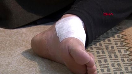 Şanlıurfa balık almaya giden kadın, köpeğin saldırısına uğradı - ek