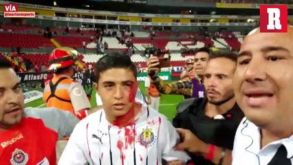 Aficionado de las Chivas fue agredido en Clásico Tapatío