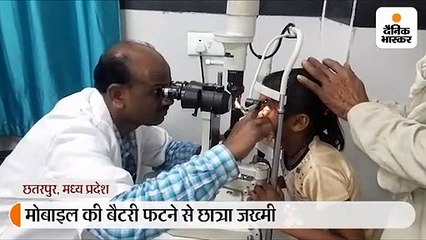 मोबाइल की बैटरी फटने से बच्ची घायल, गंभीर हालत में ग्वालियर रेफर