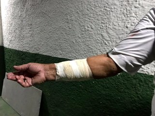 Rakip taraftarlar, Portuguesa'nın soyunma odasını bastı ve teknik ekibe saldırdı