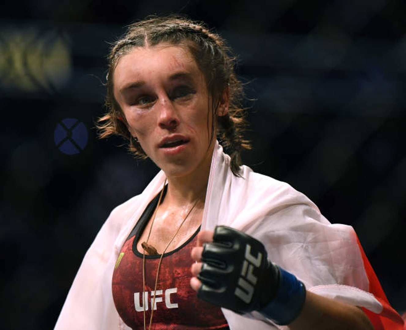 Joanna Jedrzejczyk Sustains Brutal Injuries in UFC 248 Fight Against Zhang Weili