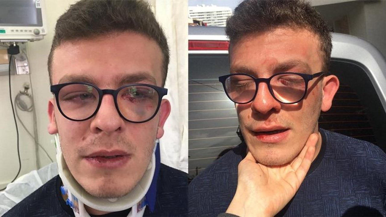 Bu nasıl bir vicdansızlık! Engelli gence dehşeti yaşattı, serbest kaldı