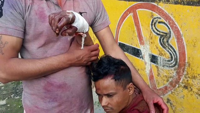 शामली: पुरानी रंजिश के चलते युवक पर धारदार हथियारों से किया हमला
