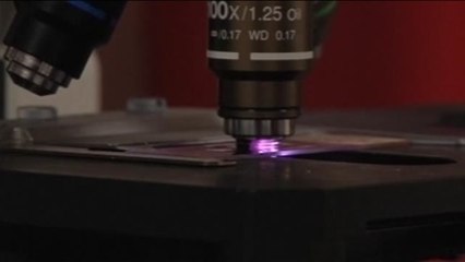 Segundo caso mundial de un paciente de sida curado