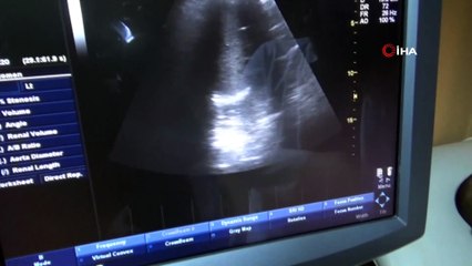 Askerlik muayenesinde şok oldu...Bütün iç organlarının ters olduğu ortaya çıktı