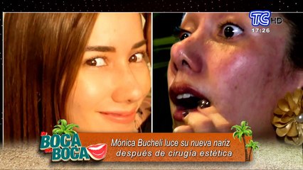 VIDEO | Mónica Bucheli luce su nueva nariz tras cirugía de reconstrucción