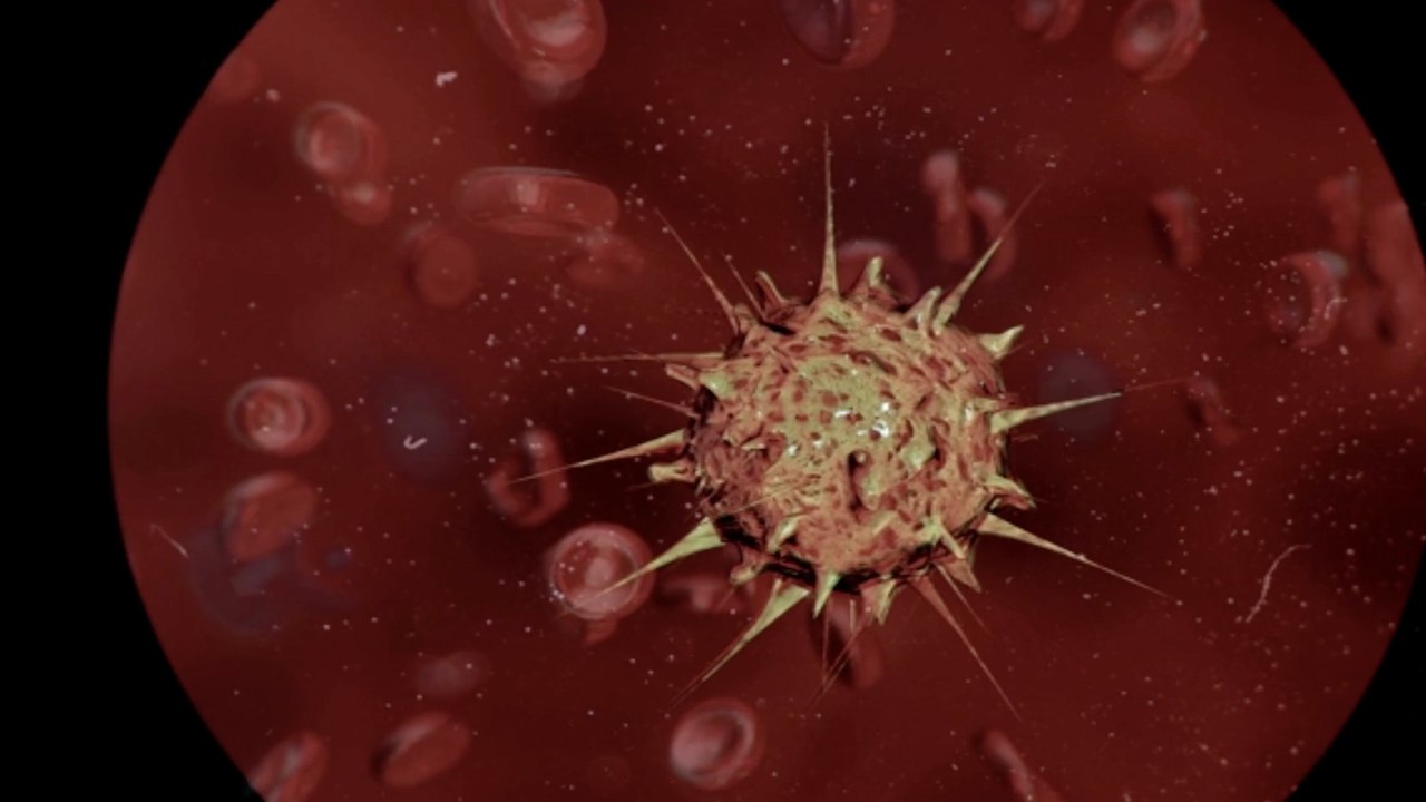 Wie das Coronavirus den Körper angreift