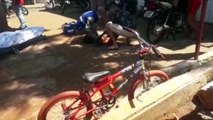 Jovem fratura o tornozelo após colisão entre carro e moto
