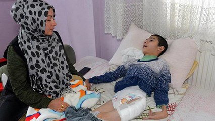 Korkunç iddia: Fizyoterapist engelli çocuğun bacağını kırıp eve gönderdi