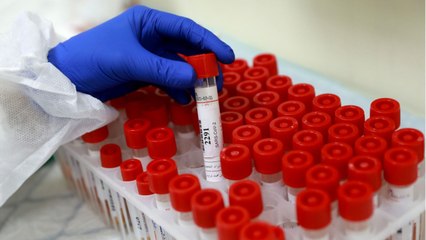 U.S. CDC Reports First Staff Case Of Coronavirus