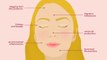 Acne Face Mapping: What Your Breakouts Are Trying to Tell You