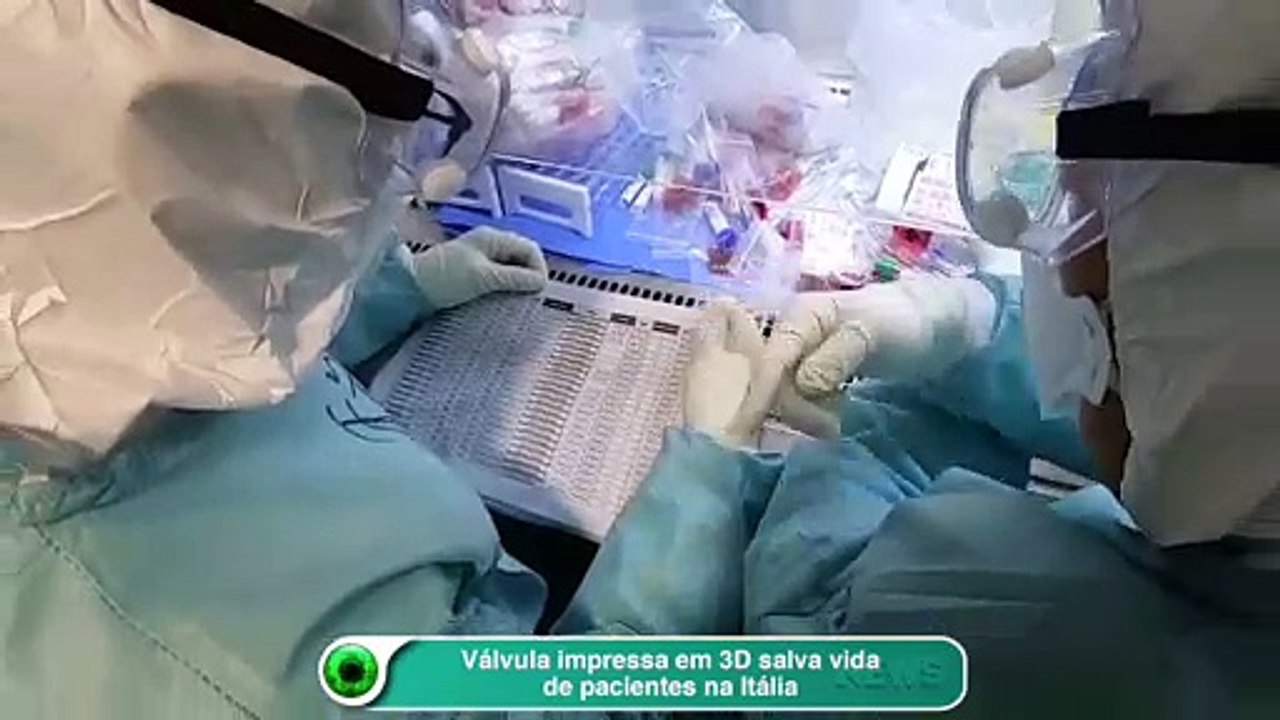 Válvula impressa em 3D salva vida de pacientes na Itália