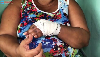 ERRO MÉDICO: MULHER PRECISA DE AJUDA APÓS ACIDENTE DE TRABALHO EM ITAMBÉ