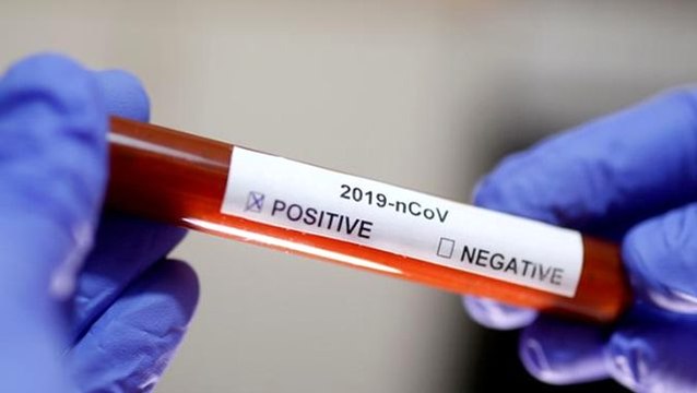 Son dakika: Koronavirüs testi yaptıranlar test sonuçlarına e-Nabız uygulamasından ulaşabilecek